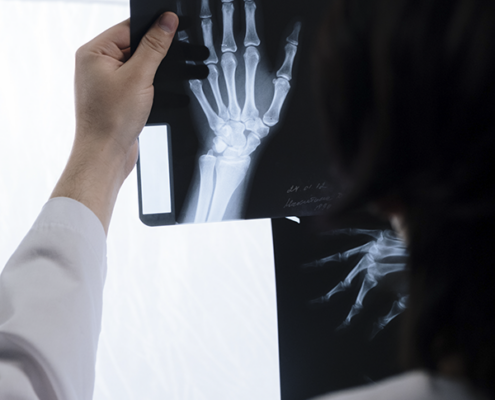 Someone holding up an x-ray scan of someone's hand